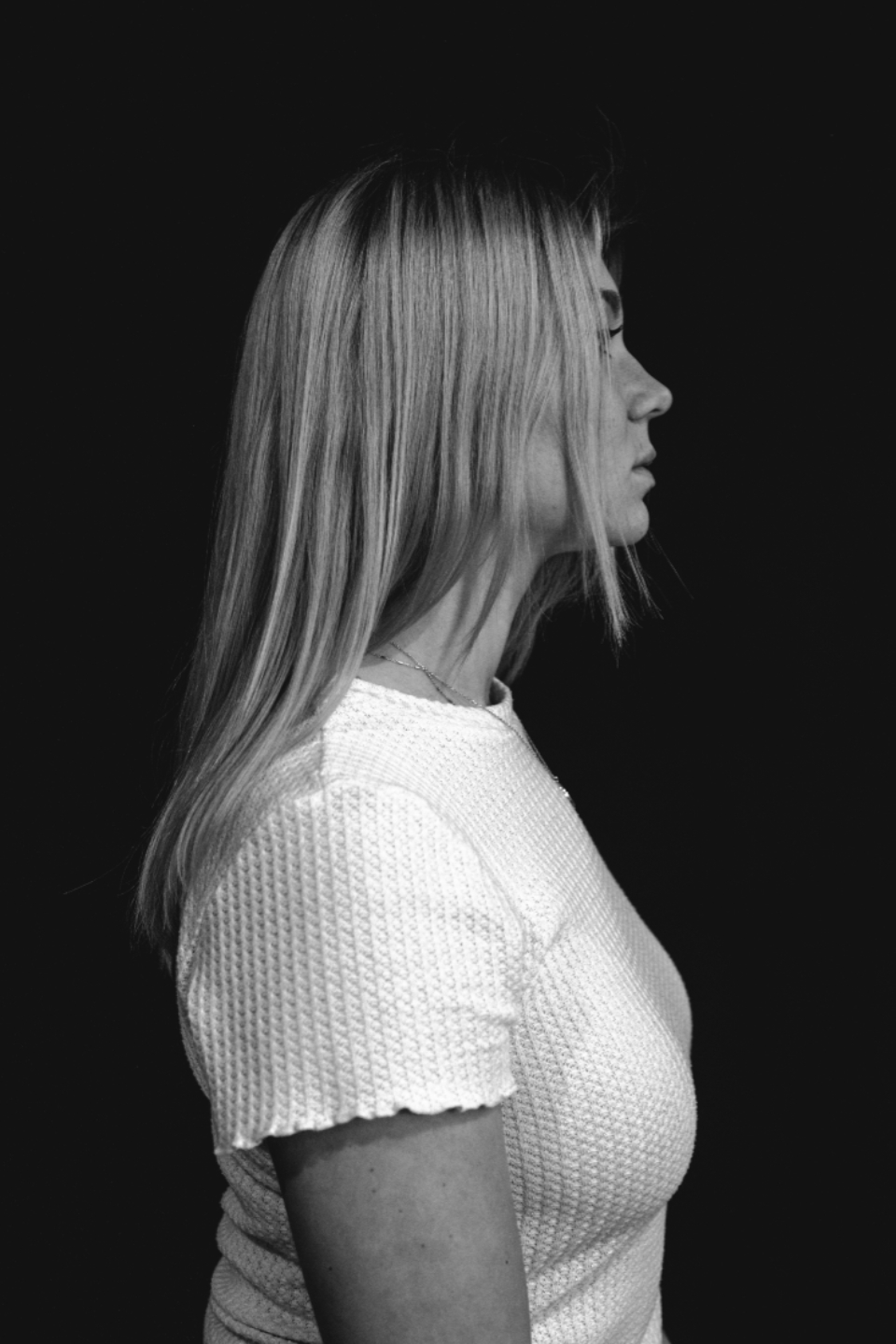 Rhinoplastie médicale à Agen et Toulouse - profil du nez d'une femme